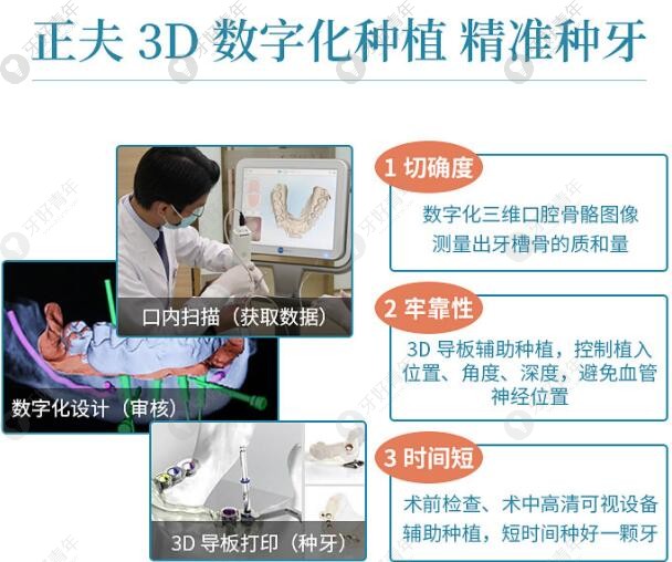 深圳正夫口腔3D数字化导板种植牙技术