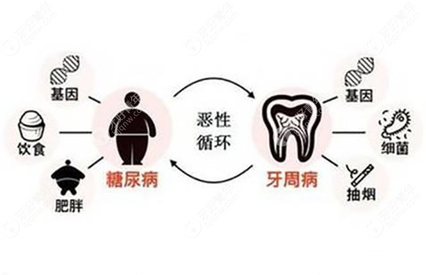 为什么糖尿病患者要慎重种牙