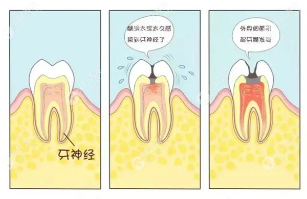 牙齿痛的原因