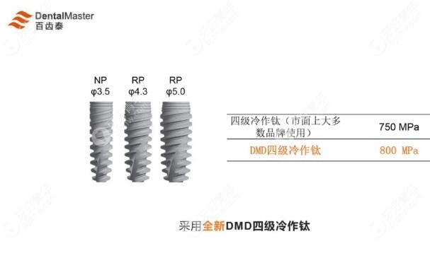想知道国产百齿泰种植牙怎么样?必了解种植体有哪些优点