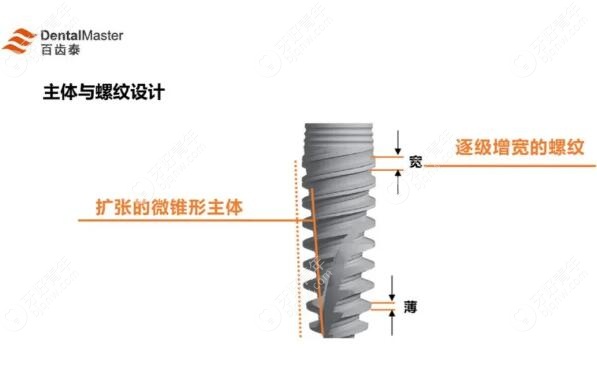 想知道国产百齿泰种植牙怎么样?必了解种植体有哪些优点