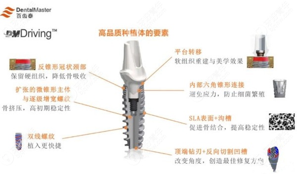 想知道国产百齿泰种植牙怎么样?必了解种植体有哪些优点