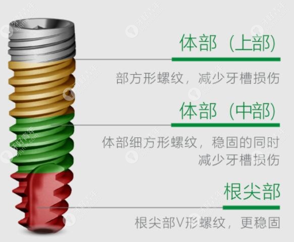 德国卡瓦ABT种植系统设计