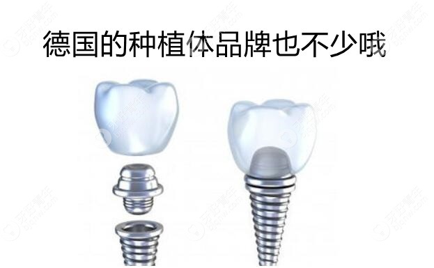 种植牙中德国和意大利品牌哪个好?比如BB和ICX植体有啥区别