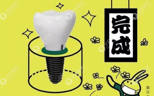 两种种植体大pk