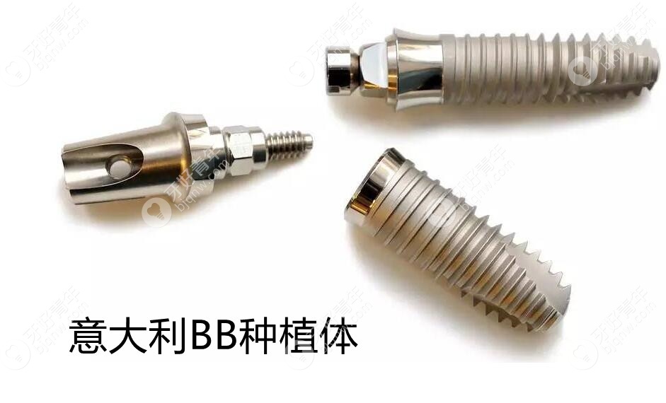 种植牙中德国和意大利品牌哪个好?比如BB和ICX植体有啥区别