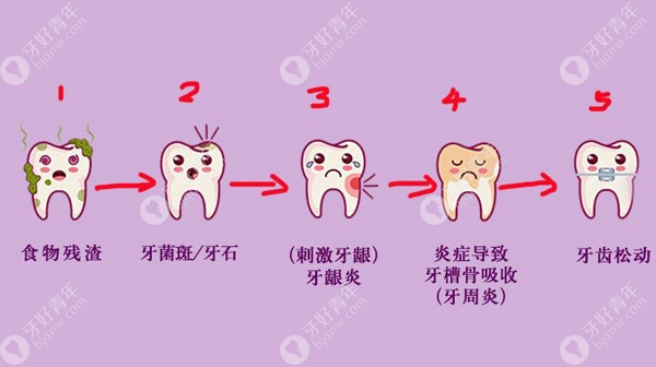 牙齿快速美白的方法有几种呢