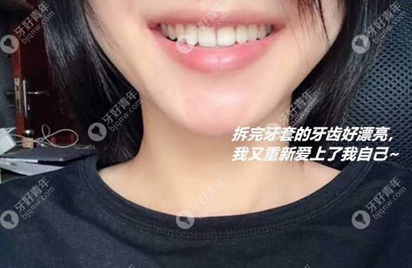 正畸收缝后还要多久能拆牙套？科普摘除牙套的合适时机