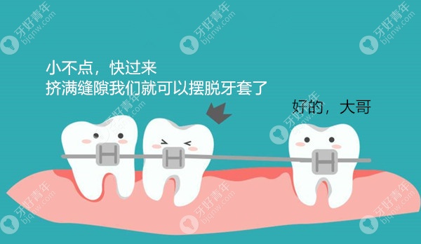 正畸收缝后还要多久能拆牙套？科普摘除牙套的合适时机