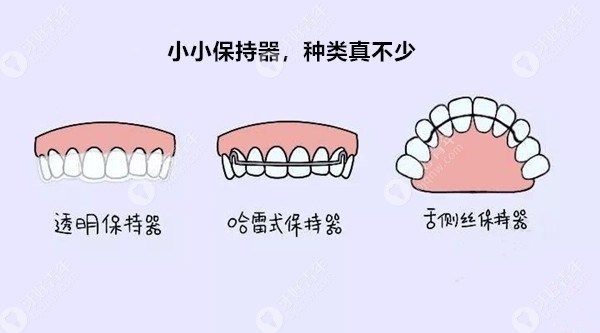 保持器的种类有哪些？