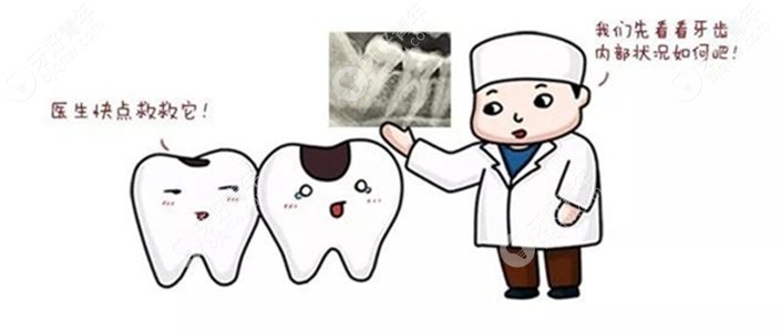 牙齿凹槽有黑线是牙齿龋坏吗？