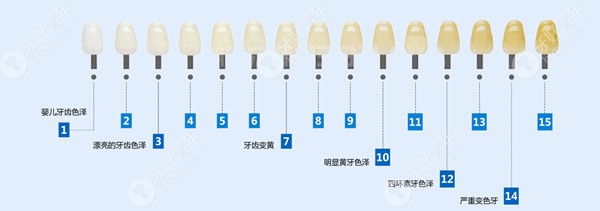 四月优惠来袭,只要680元即可获得植适白皓得适牙齿美白一次