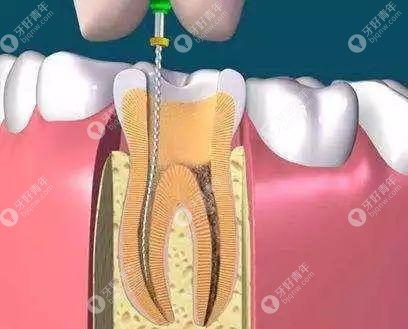 牙龈肿胀白色的脓包是什么原因造成的？真相竟是....