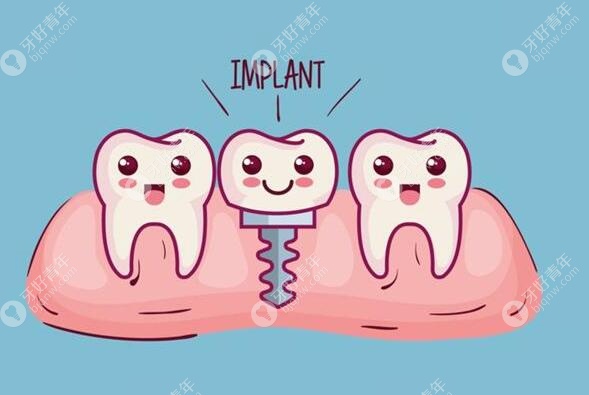 为了知道2021年种植牙多少钱一颗?我把各地种牙价格表都翻烂