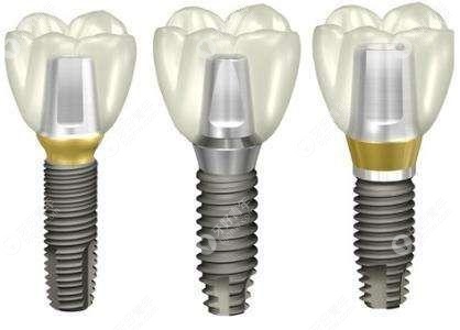 从价格和寿命判断美国皓圣和韩国登腾哪个种植体好？