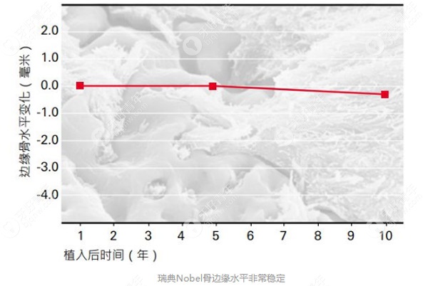 瑞典Nobel骨边缘水平非常稳定