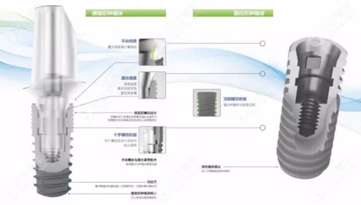 国产康盛亲水种植体和奥齿泰的价格、寿命对比后，这么选