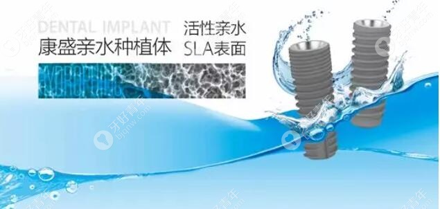 国产康盛亲水种植体和奥齿泰的价格、寿命对比后，这么选