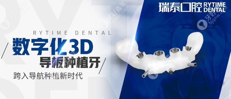 数字化3D导板种植牙