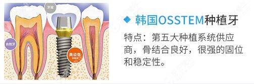Osstem奥齿泰系统