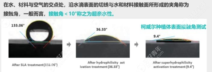 柯威尔种植体是亲水植体