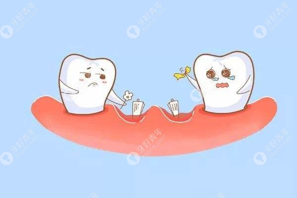牙齿缺失修复方式