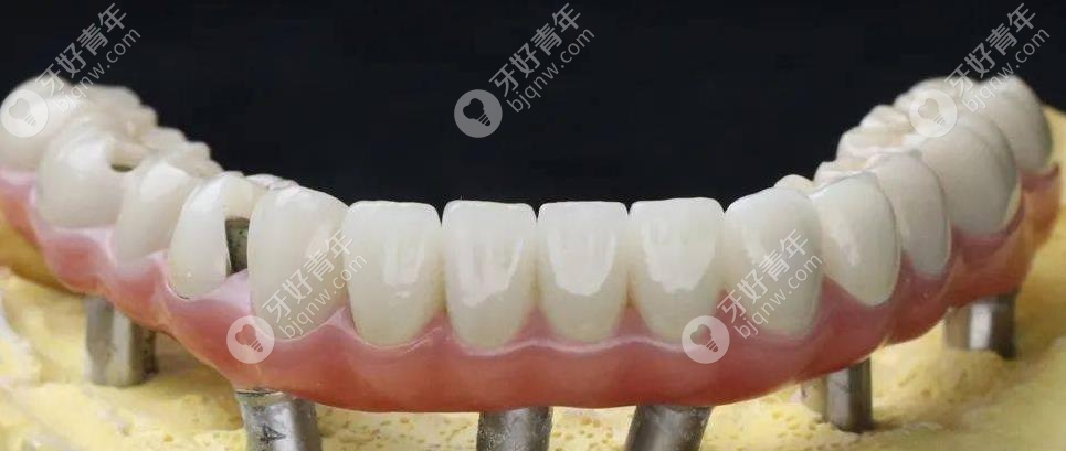 马龙桥修复