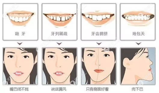 成年人做牙齿矫正费用较高