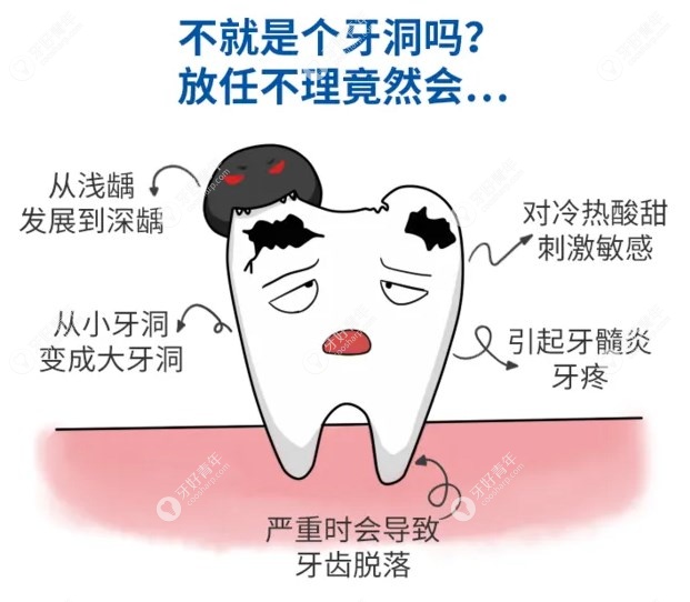 为啥有人宁愿虫牙继续蛀也不愿意补牙