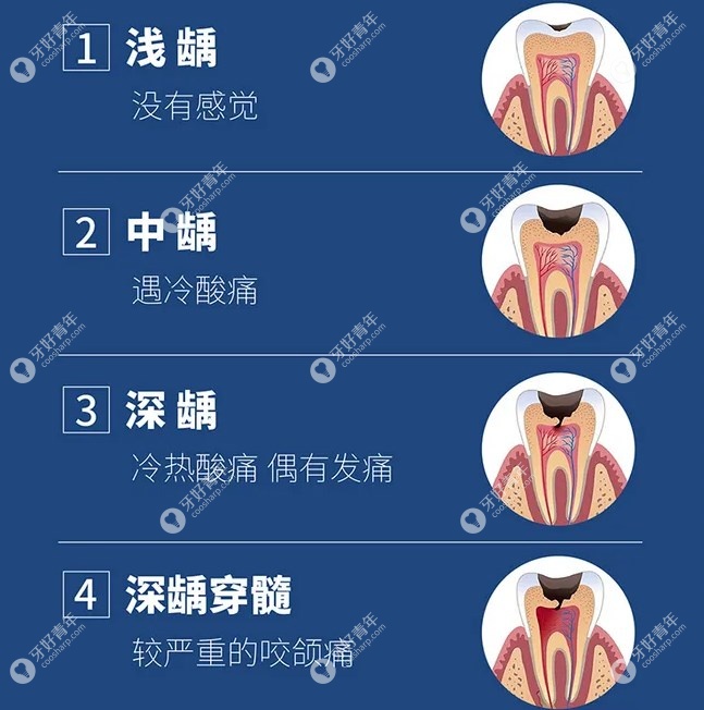 蛀牙可以自己愈合吗