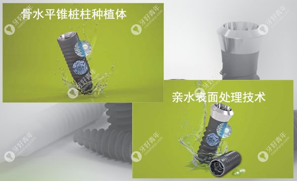 瑞士iti种植牙2颗3万是划算的