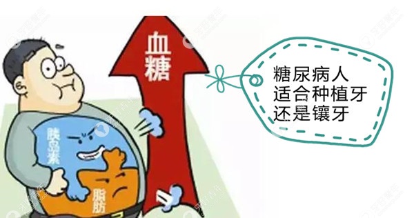 糖尿病人适合种植牙还是镶牙