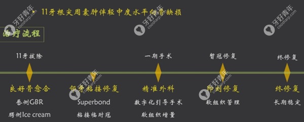 前牙美学区用骨增量技术做种植牙的实例