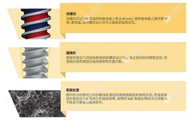 以色列mis种植体的特点