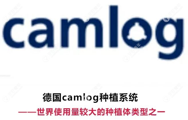 德国camlog卡姆洛种植牙是终身质保吗