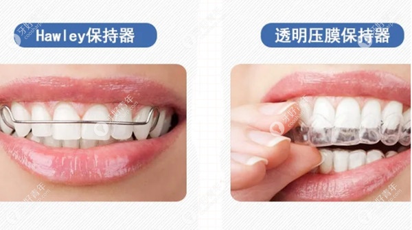 为啥钢丝保持器要比透明保持器贵