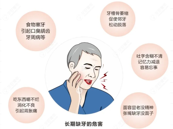 看看长期牙齿缺失有哪些危害吧