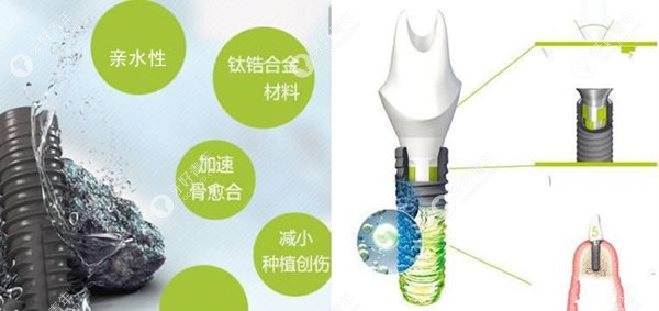 韩国迪奥DIO  UV Active亲水种植体