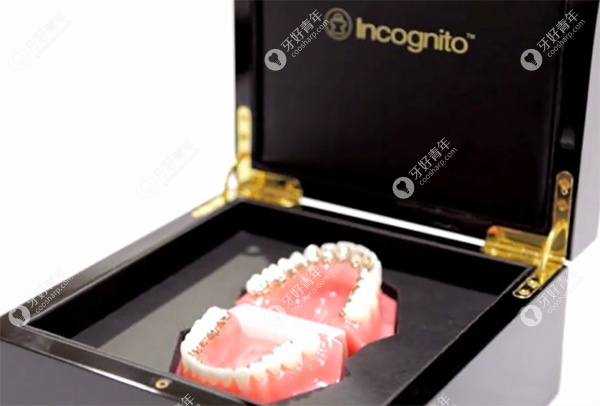 美国3M Incognito黄金舌侧矫正