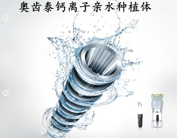 韩国奥齿泰Osstem亲水种植体