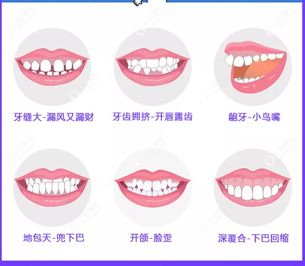 南昌虹桥口腔正畸收费价格
