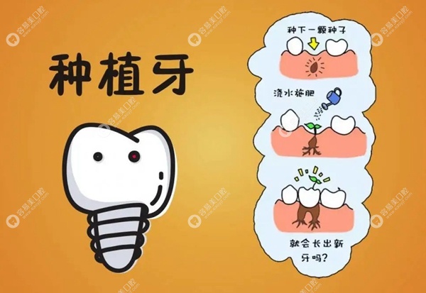韩国种植牙品牌排行榜 easyjf.com