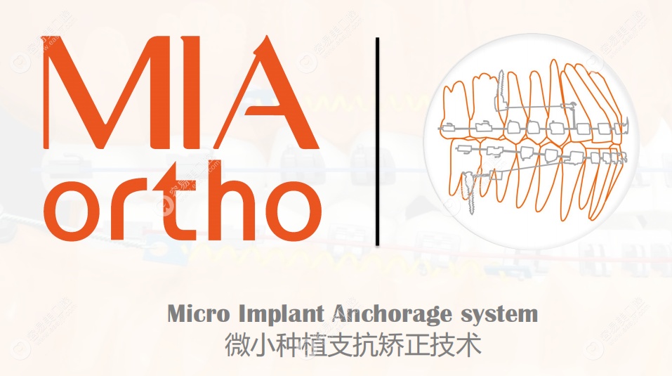 微种植支抗骨钉颜面矫正技术（MIA）