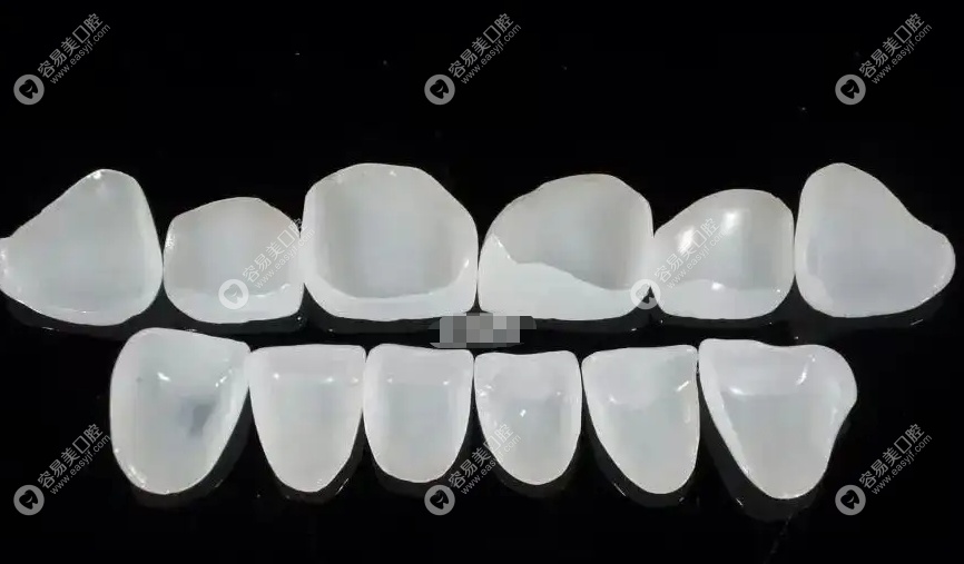 杭州牙科医院牙齿修复怎么样