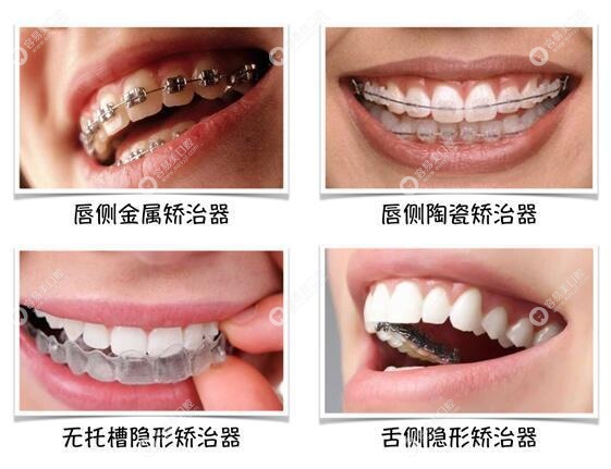 北京仁爱门诊部口腔科牙齿矫正