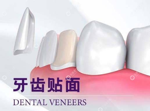 成都牙管家口腔贴面收费价格easyjf.com