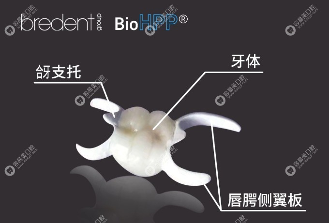 活动假牙hpp是高分子陶瓷聚合物材料