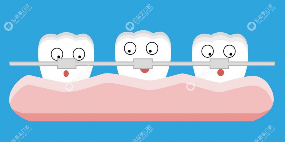 牙齿矫正卡通图