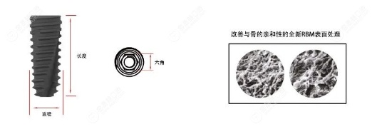 每舒达植体外观