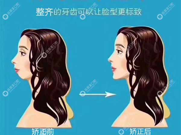 矫正牙齿选择医院和诊所的区别easyjf.com